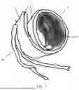 Fig. 04 - ROLLABLE SANDAL SHOE