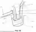 Fig. 26 - SOLE STRUCTURES AND ARTICLES OF FOOTWEAR HAVING CONFORMABLE HEEL COUNTER STRUCTURES