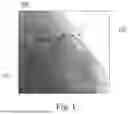 Fig. 02 - Filter Control for a Medical Imaging System