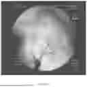 Fig. 09 - SURGICAL DEVICES AND METHODS OF USE THEREOF