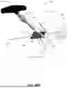 Fig. 46 - FEMORAL FIXATION DEVICES, SYSTEMS, AND METHODS