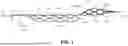 Fig. 02 - THROMBECTOMY DEVICE HAVING OPEN FRAME CELL RING