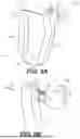 Fig. 06 - MEDICAL DEVICES AND RELATED METHODS