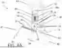 Fig. 07 - Variable Angle Plate Tensioning Devices