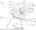 Fig. 08 - Variable Angle Plate Tensioning Devices