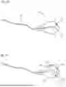 Fig. 02 - DEVICE AND METHOD FOR ABLATIVE TREATMENT OF TARGETED AREAS WITHIN A BODY LUMEN