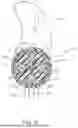 Fig. 05 - ARTICULATION SECTION FOR SHAFT ASSEMBLY OF SURGICAL INSTRUMENT