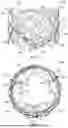 Fig. 04 - PROSTHETIC HEART VALVE LEAFLET ASSEMBLIES AND METHODS