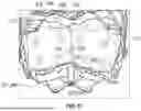 Fig. 13 - PROSTHETIC HEART VALVE LEAFLET ASSEMBLIES AND METHODS