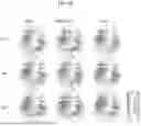 Fig. 10 - BRAIN STIMULATION SYSTEMS AND METHODS