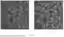 Fig. 13 - BRAIN STIMULATION SYSTEMS AND METHODS