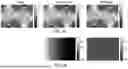 Fig. 08 - METHODS AND RELATED ASPECTS FOR MITIGATING UNKNOWN BIASES IN COMPUTED TOMOGRAPHY DATA