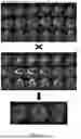 Fig. 02 - MEDICAL IMAGE MOVEMENT DETECTION AND CORRECTION METHOD AND SYSTEM, AND COMPUTER READABLE MEDIUM