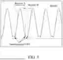 Fig. 07 - DEVICE FOR DETECTION OF A CLIPPED RINGING SIGNAL