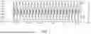 Fig. 09 - DEVICE FOR DETECTION OF A CLIPPED RINGING SIGNAL