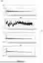 Fig. 07 - SPECTROGRAM BASED TIME ALIGNMENT FOR INDEPENDENT RECORDING AND PLAYBACK SYSTEMS