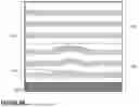 Fig. 07 - 3D NAND - HIGH ASPECT RATIO STRINGS AND CHANNELS