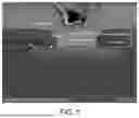 Fig. 02 - METHOD OF CONTROLLING CHANNEL LENGTH OF SIC MOSFET