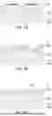 Fig. 09 - METHOD OF CONTROLLING CHANNEL LENGTH OF SIC MOSFET