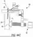 Fig. 77 - OSTEOTOMY SYSTEMS AND TECHNIQUES FOR METATARSAL CORRECTION WITH INTRAMEDULLARY INSERTION BODY