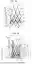 Fig. 04 - Stent Designs For Prosthetic Heart Valves