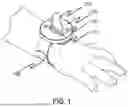 Fig. 02 - PACIFIER RETENTION APPARATUS