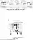 Fig. 18 - TREATMENT AND METHOD FOR INHIBITING LATE NA CURRENT