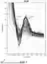 Fig. 07 - AI/ML SPINAL CORD STIMULATION SIGNAL CLASSIFICATION FOR THERAPY OPTIMIZATION AND INSIGHT