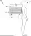 Fig. 01 - SYSTEMS AND METHODS FOR DETERMINING MINIMAL ERYTHEMA DOSE FOR PHOTOTHERAPY