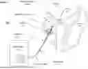 Fig. 02 - URINARY CATHETER FOR DETECTING RADIATION