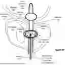 Fig. 06 - URINARY CATHETER FOR DETECTING RADIATION