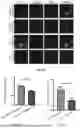 Fig. 06 - PEPTIDE INHIBITORS AND METHODS FOR INHIBITING PROTEIN AGGREGATION IN NEURONS AND NEURODEGENERATIVE DISEASES