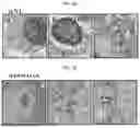 Fig. 06 - MODULATORS OF PHOSPHATIDYLSERlNE DECARBOXYLASE AND USE THEREOF