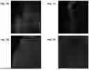 Fig. 09 - ADENO-ASSOCIATED VIRUS WITH ENGINEERED CAPSID