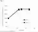 Fig. 02 - METHOD FOR IMPROVED PRODUCTION OF INTRACELLULAR PROTEINS IN BACILLUS