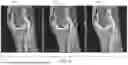 Fig. 09 - SYSTEM AND METHOD FOR ENHANCING PROPELLER IMAGE QUALITY BY DENOISING BLADES