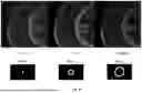 Fig. 11 - METHOD AND APPARATUS FOR RAPID DEPTH-SCANNING IN LASER IMAGING