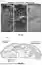 Fig. 08 - SYSTEMS AND METHODS FOR TISSUE IMAGING
