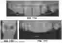 Fig. 17 - COMPUTER IMPLEMENTED METHODS FOR DENTAL DESIGN