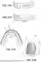 Fig. 29 - COMPUTER IMPLEMENTED METHODS FOR DENTAL DESIGN