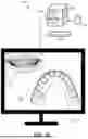 Fig. 34 - COMPUTER IMPLEMENTED METHODS FOR DENTAL DESIGN