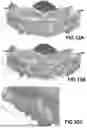 Fig. 35 - COMPUTER IMPLEMENTED METHODS FOR DENTAL DESIGN