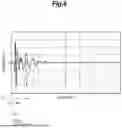 Fig. 07 - ACTIVE NOISE REDUCTION SYSTEM