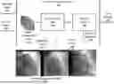 Fig. 01 - POST-PCI CORONARY ANALYSIS