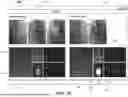 Fig. 09 - POST-PCI CORONARY ANALYSIS