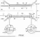 Fig. 04 - SURGICAL DEVICE FOR CONTROLLED ANCHORING IN THE INTESTINE