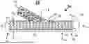 Fig. 01 - GRAFT WITH EXPANDABLE REGION AND METHODS OF MAKING AND USING THE SAME