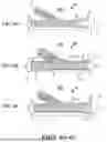 Fig. 07 - GRAFT WITH EXPANDABLE REGION AND METHODS OF MAKING AND USING THE SAME