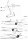 Fig. 02 - THROMBECTOMY DEVICES WITH LATERAL AND VERTICAL BIAS