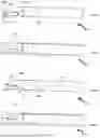 Fig. 06 - THROMBECTOMY DEVICES WITH LATERAL AND VERTICAL BIAS